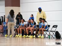 15U vs OTP
