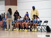 15U vs OTP