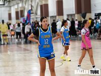 15U vs OTP