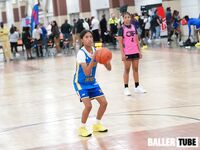 15U vs OTP