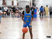 15U vs OTP