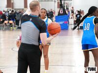 15U vs OTP